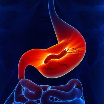 HELICOBACTER PYLORI